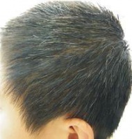 “少白头”可能与DNA损伤有关